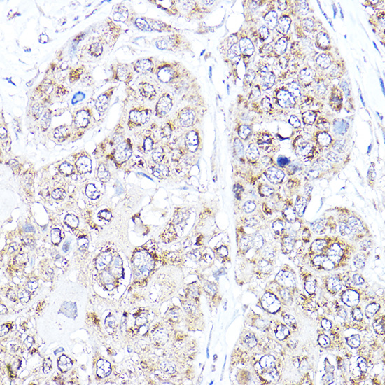 A12303_IHC_01_(1078779).jpg