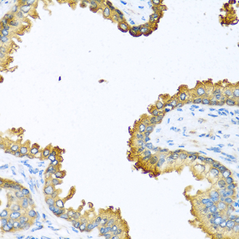 A12530_IHC_01_(12219).jpg