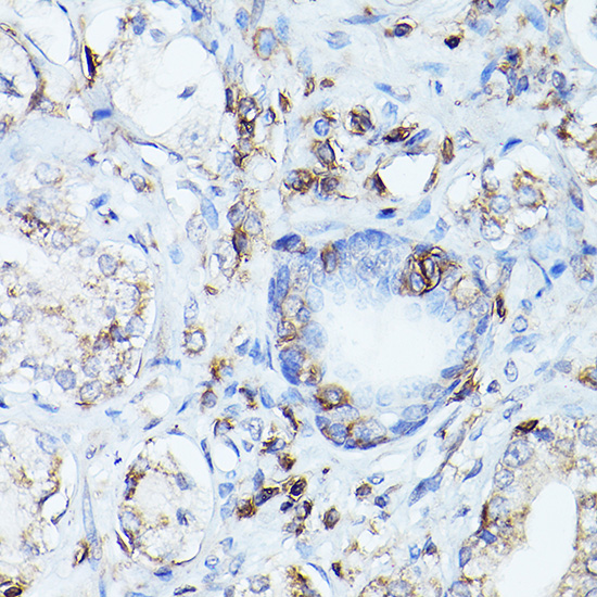 A2115_IHC_03_(1080804).jpg